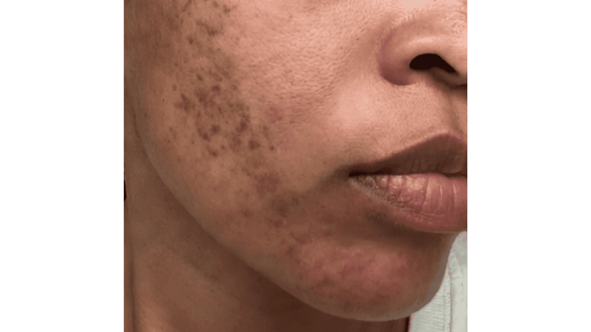 I Spent $12,800 on Skincare. Here's What I Actually Learned.