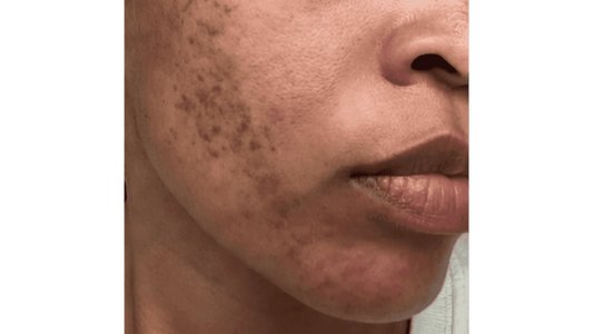 I Spent $12,800 on Skincare. Here's What I Actually Learned.