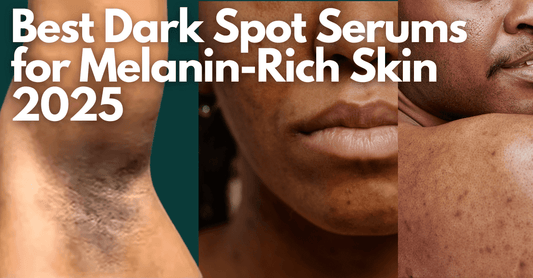 Best Dark Spot Serums for Melanin-Rich Skin 2025: Expert Picks