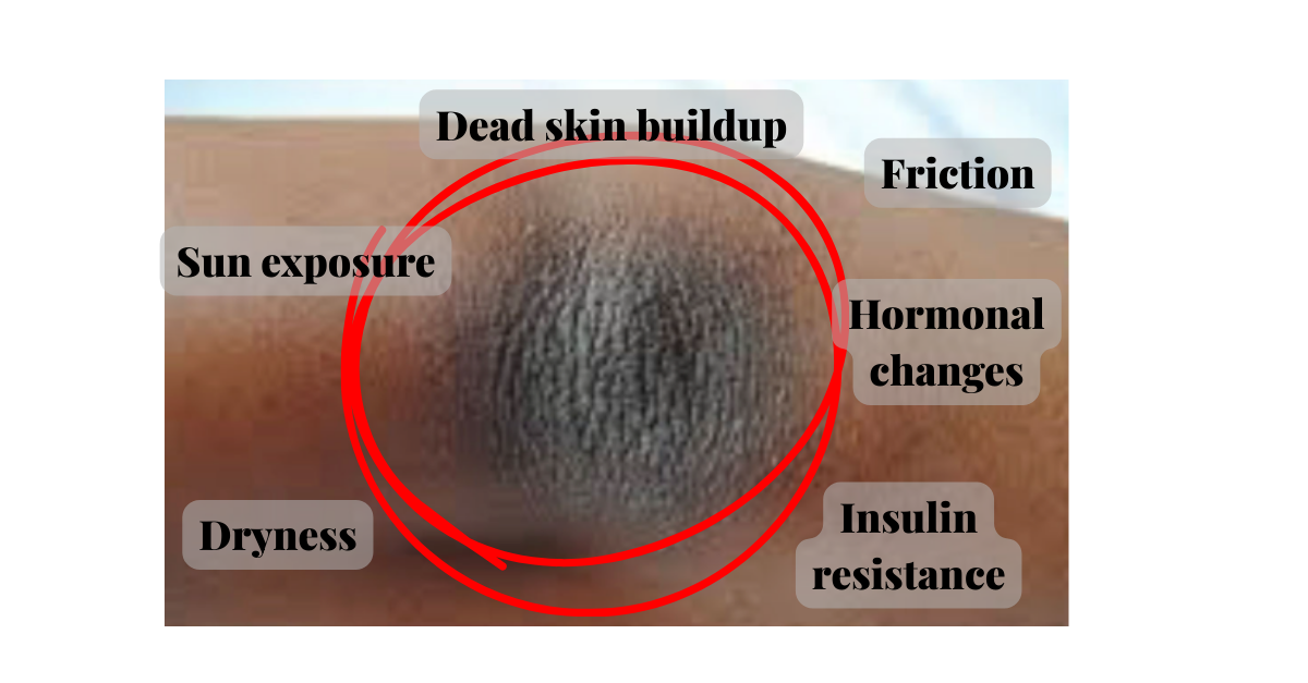 Dark Knees & Elbows on Black Skin: Causes & Safe Fading Guide
