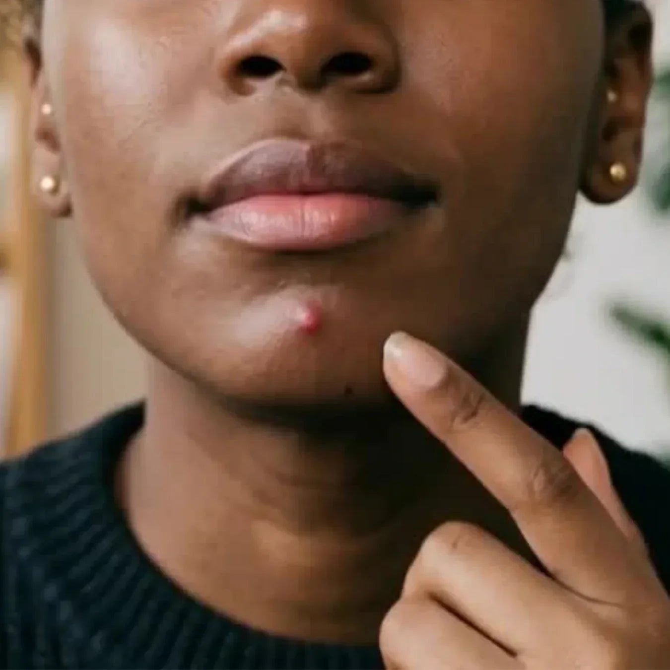 "How a Korean skincare hack helped me stay acne-free for 2 years using nothing more than 60 seconds a day."