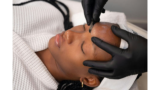 Is Glycolic Acid Safe for Dark Skin?