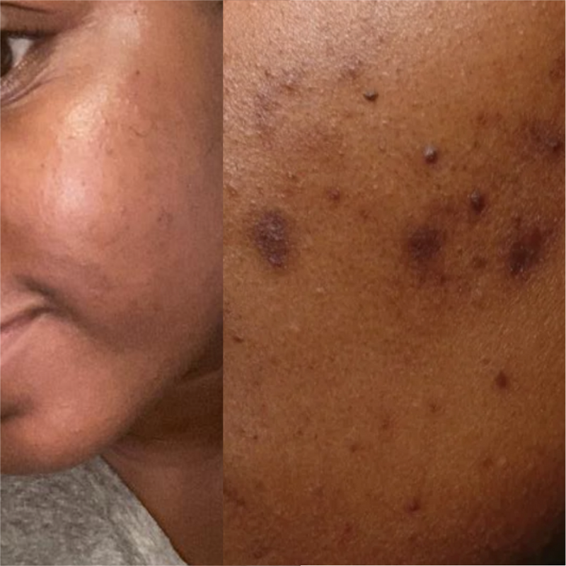 Korean Skincare for Black and Brown Skin