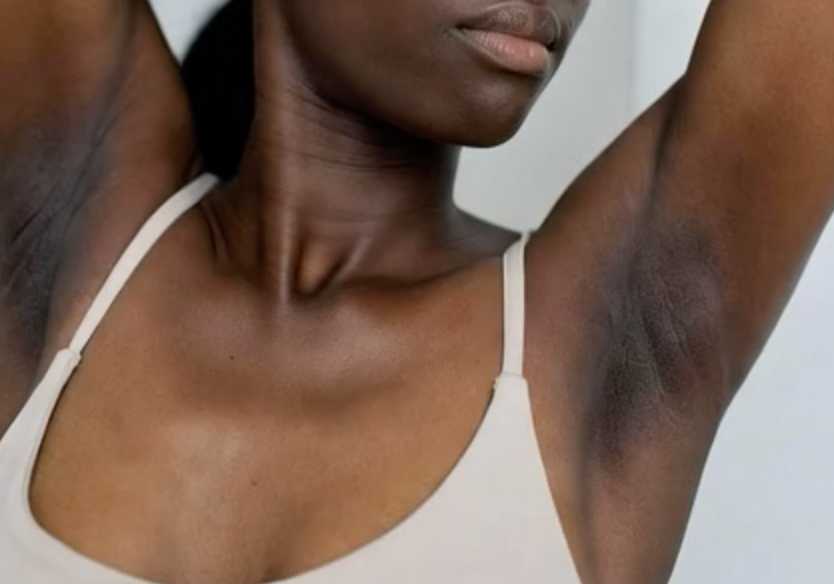 Dark underarms- VOUEE Best skincare for darker skin