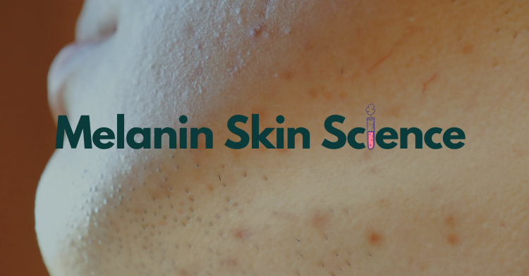 Blog: Melanin_Skin_Science
