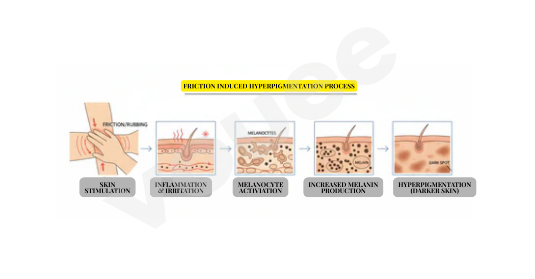 friction_hyperpigmentaton_process