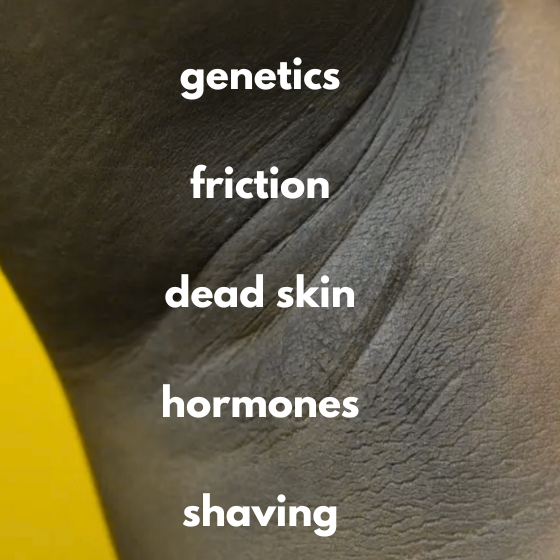 talking about VOUEE ZURI Body toner for dark inner thighs, under arms, knees